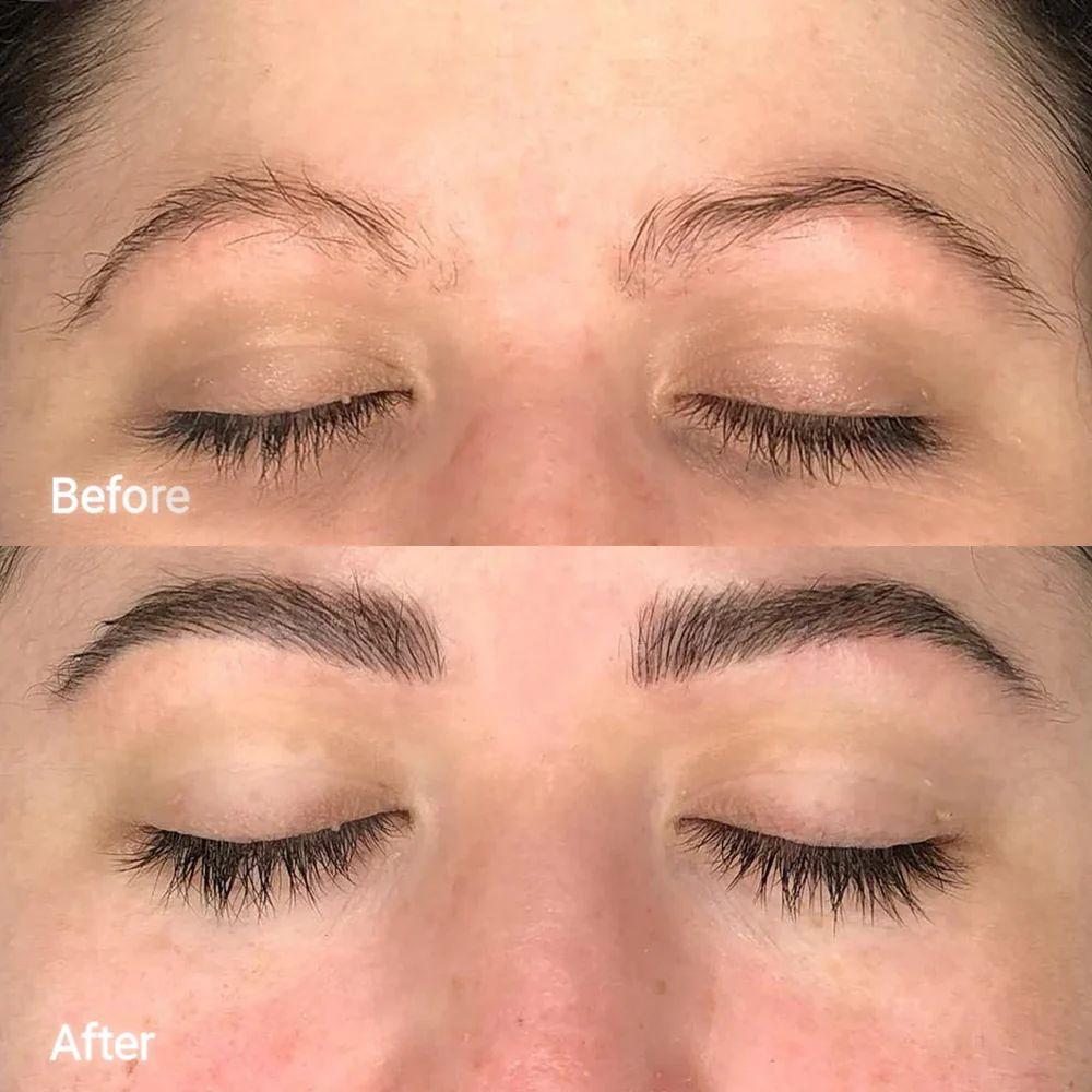 Anti Eye Bag Serum Roller