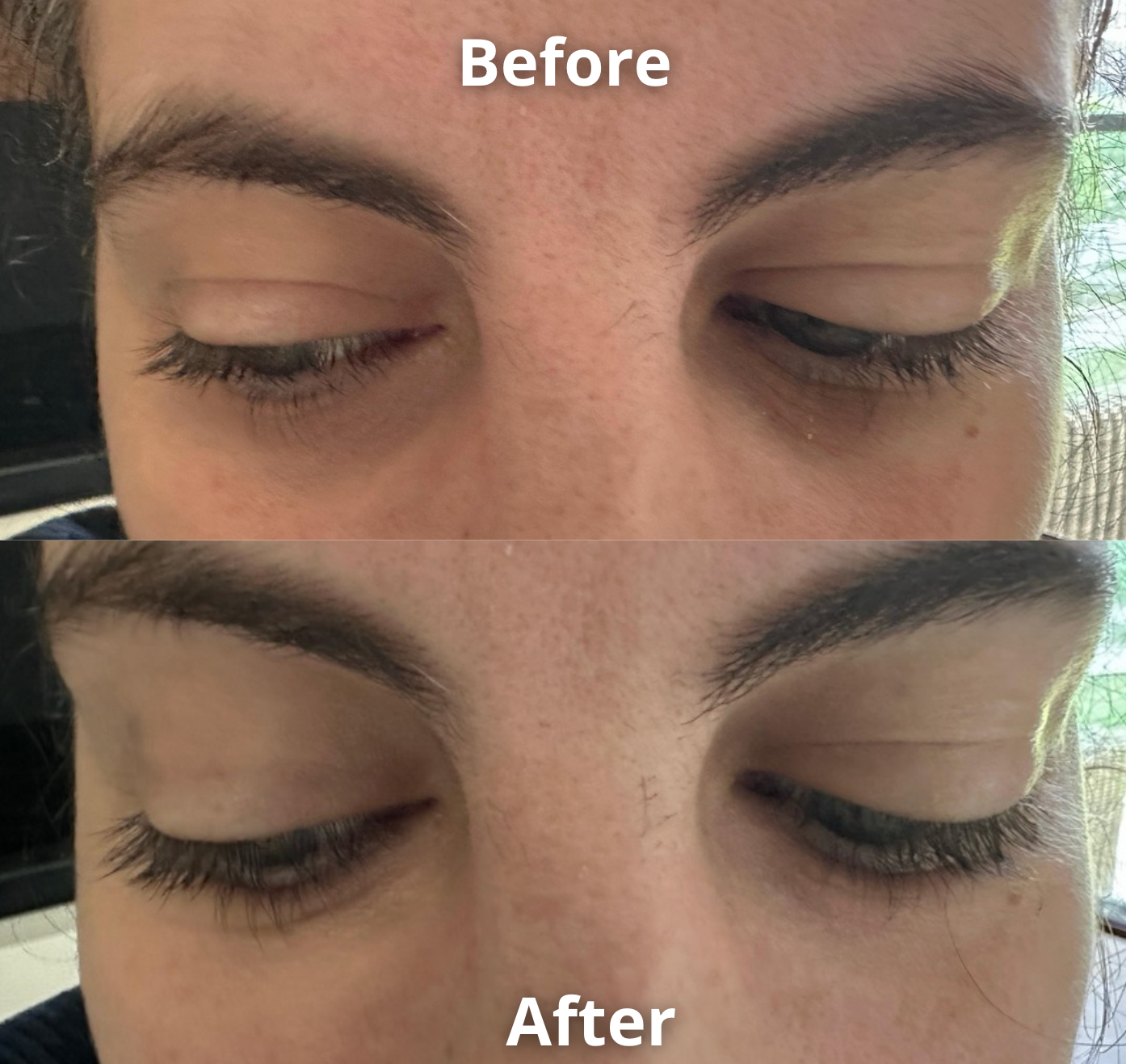 Anti Eye Bag Serum Roller