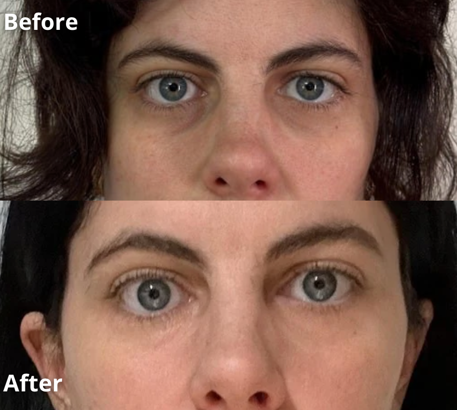Anti Eye Bag Serum Roller