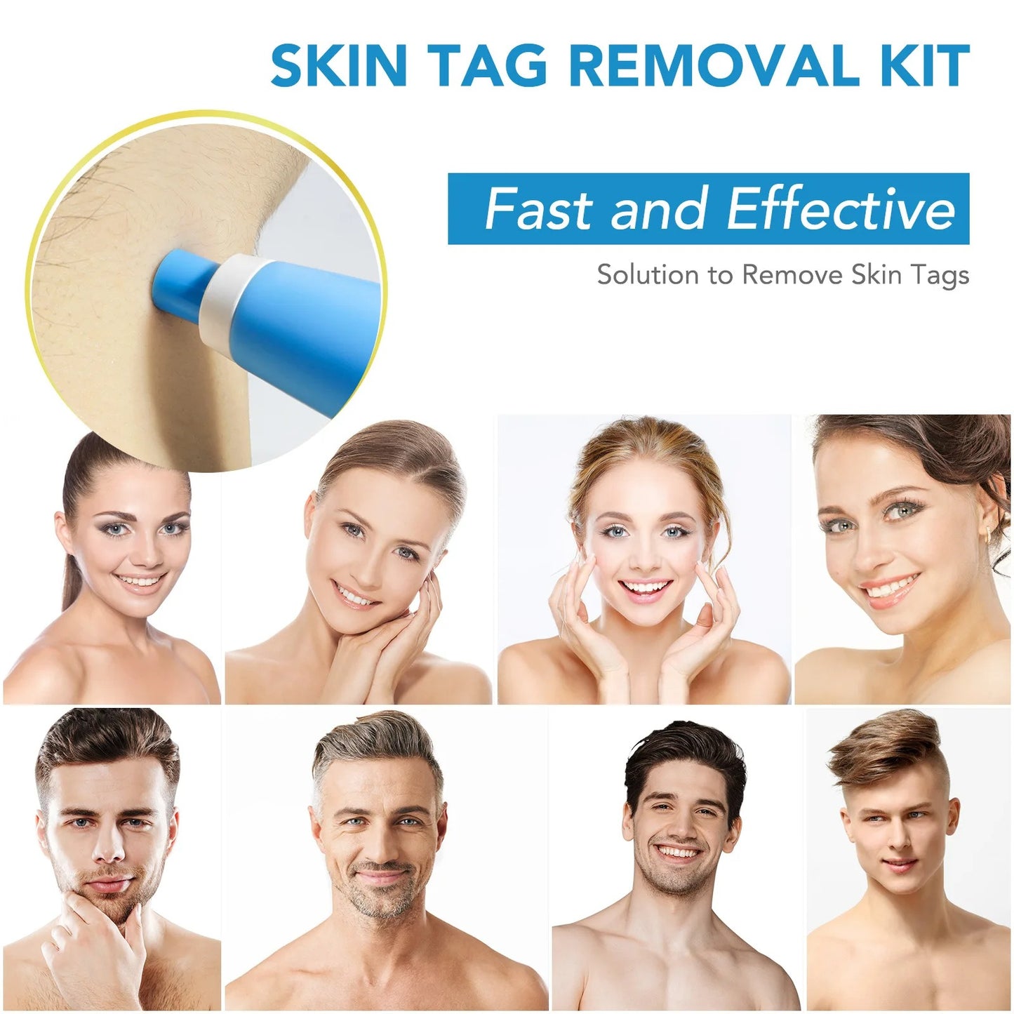 2-in-1 Auto Skin Tag Remover Kit for Moles, Warts & Stains
