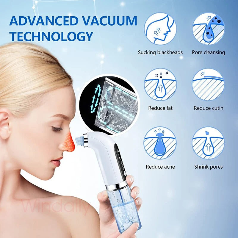2025 Blackhead Remover & Pore Vacuum