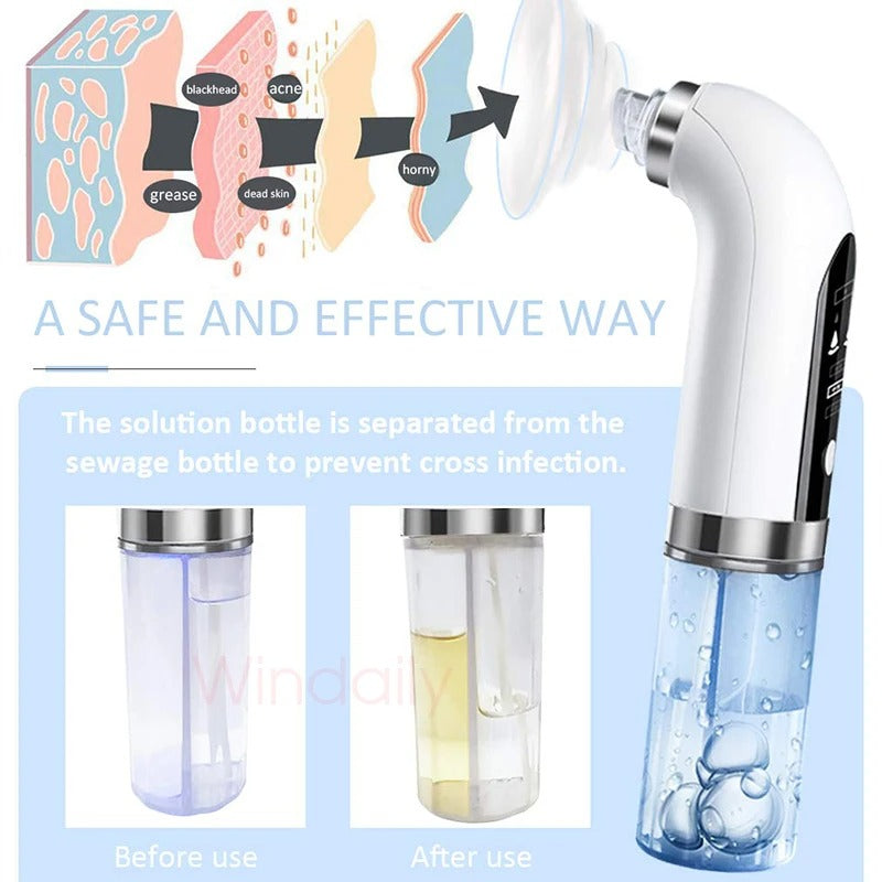 2025 Blackhead Remover & Pore Vacuum