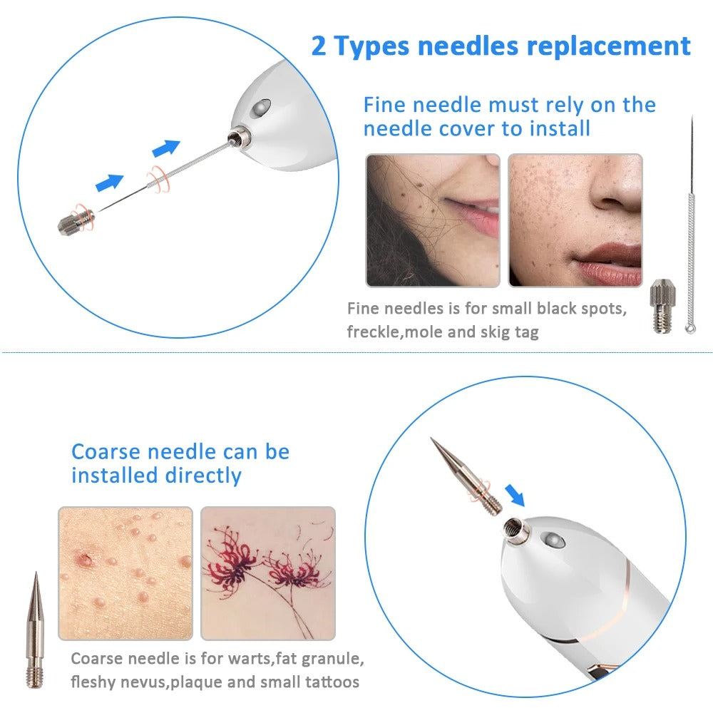 Laser Plasma Skin Tag Remover Pen Mole Freckle Eliminator