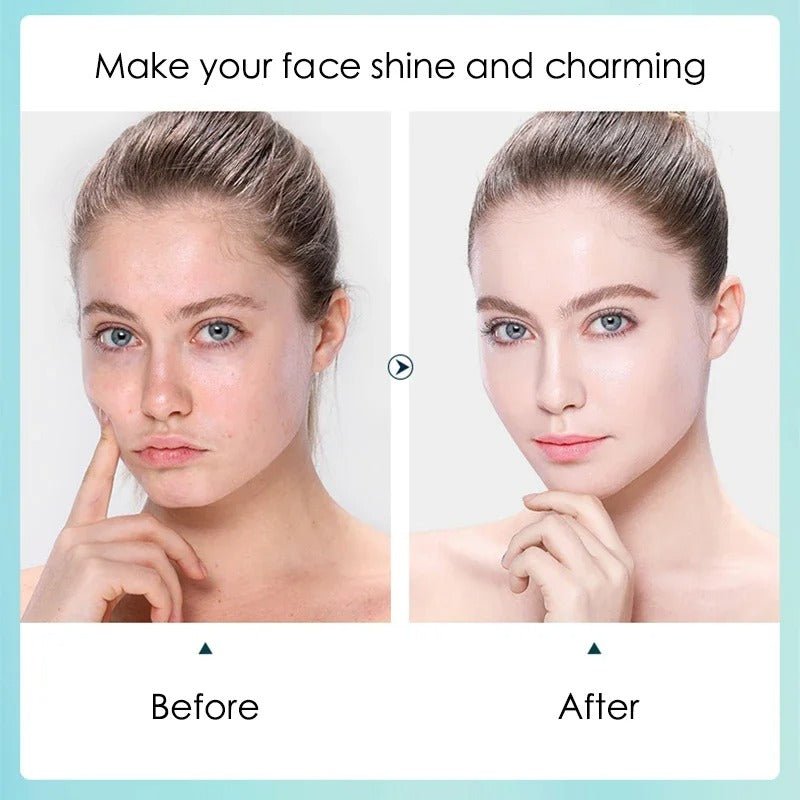 10pcs Hyaluronic Acid Facial Mask – Hydrating & Pore Refining Skincare - RESTORALUX