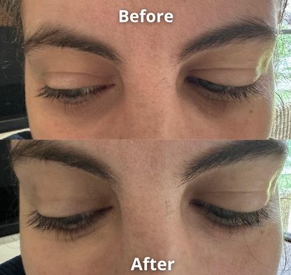 Anti Eye Bag Serum Roller