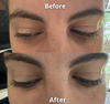 Anti Eye Bag Serum Roller
