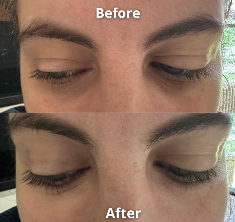 Anti Eye Bag Serum Roller