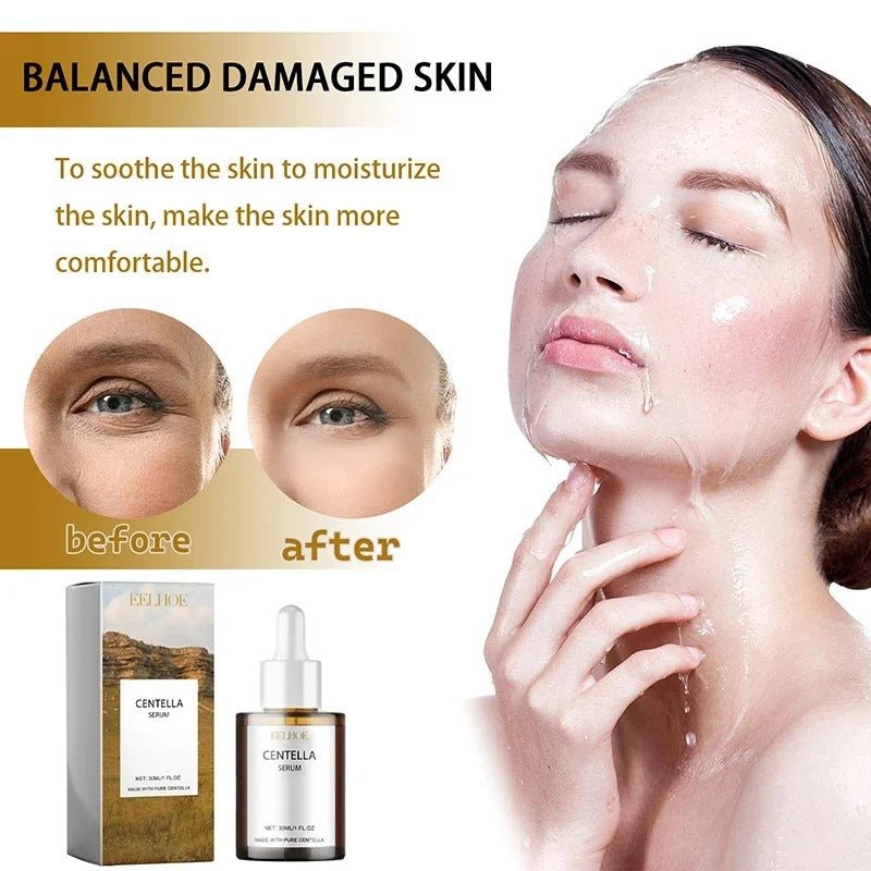 Centella Asiatica Face Serum – Hydrating, Brightening & Skin Repair [30mL] - RESTORALUX