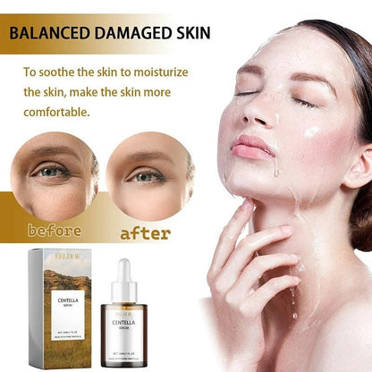 Centella Asiatica Face Serum – Hydrating, Brightening & Skin Repair [30mL] - RESTORALUX