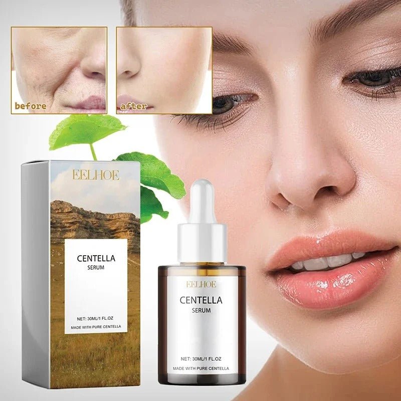 Centella Asiatica Face Serum – Hydrating, Brightening & Skin Repair [30mL] - RESTORALUX