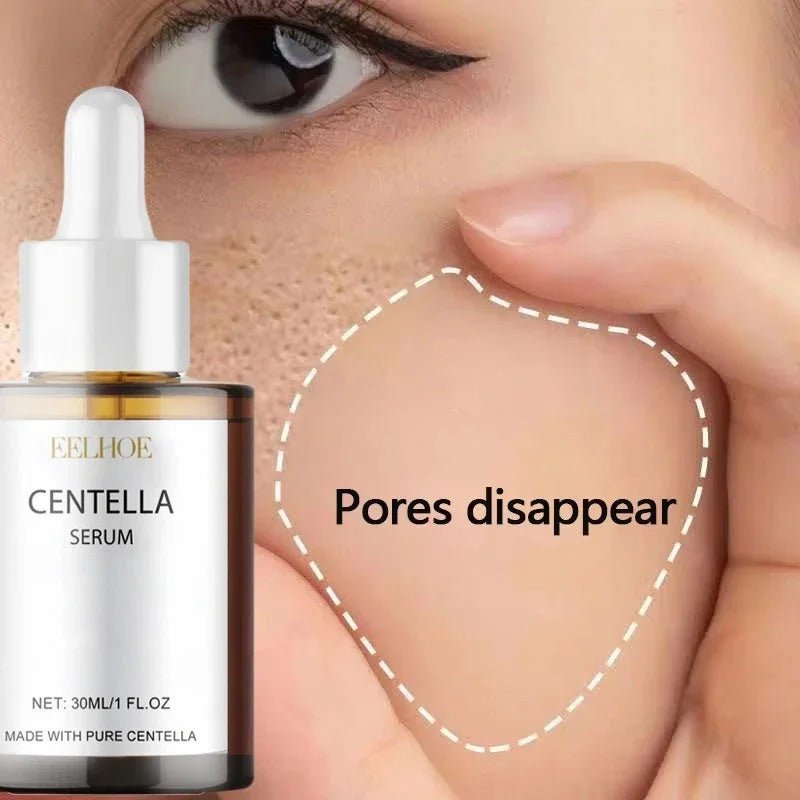 Centella Asiatica Face Serum – Hydrating, Brightening & Skin Repair [30mL] - RESTORALUX