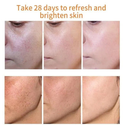 Dark Spot Remover Whitening Serum – Anti - Pigmentation & Brightening - RESTORALUX