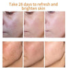 Dark Spot Remover Whitening Serum – Anti - Pigmentation & Brightening - RESTORALUX