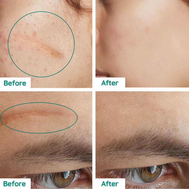 DermaRenew Scar Repair Skin Toner for Smooth Clear Skin - RESTORALUX