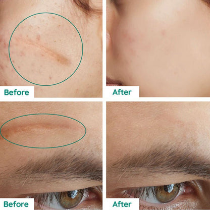 DermaRenew Scar Repair Skin Toner for Smooth Clear Skin - RESTORALUX