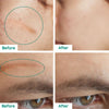 DermaRenew Scar Repair Skin Toner for Smooth Clear Skin - RESTORALUX