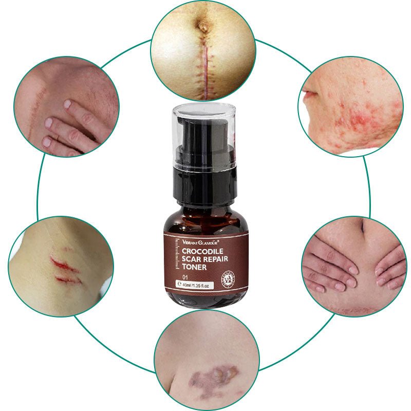 DermaRenew Scar Repair Skin Toner for Smooth Clear Skin - RESTORALUX