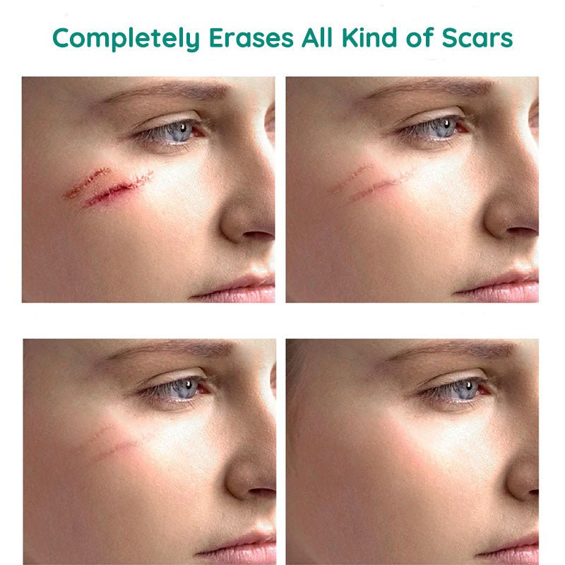 DermaRenew Scar Repair Skin Toner for Smooth Clear Skin - RESTORALUX