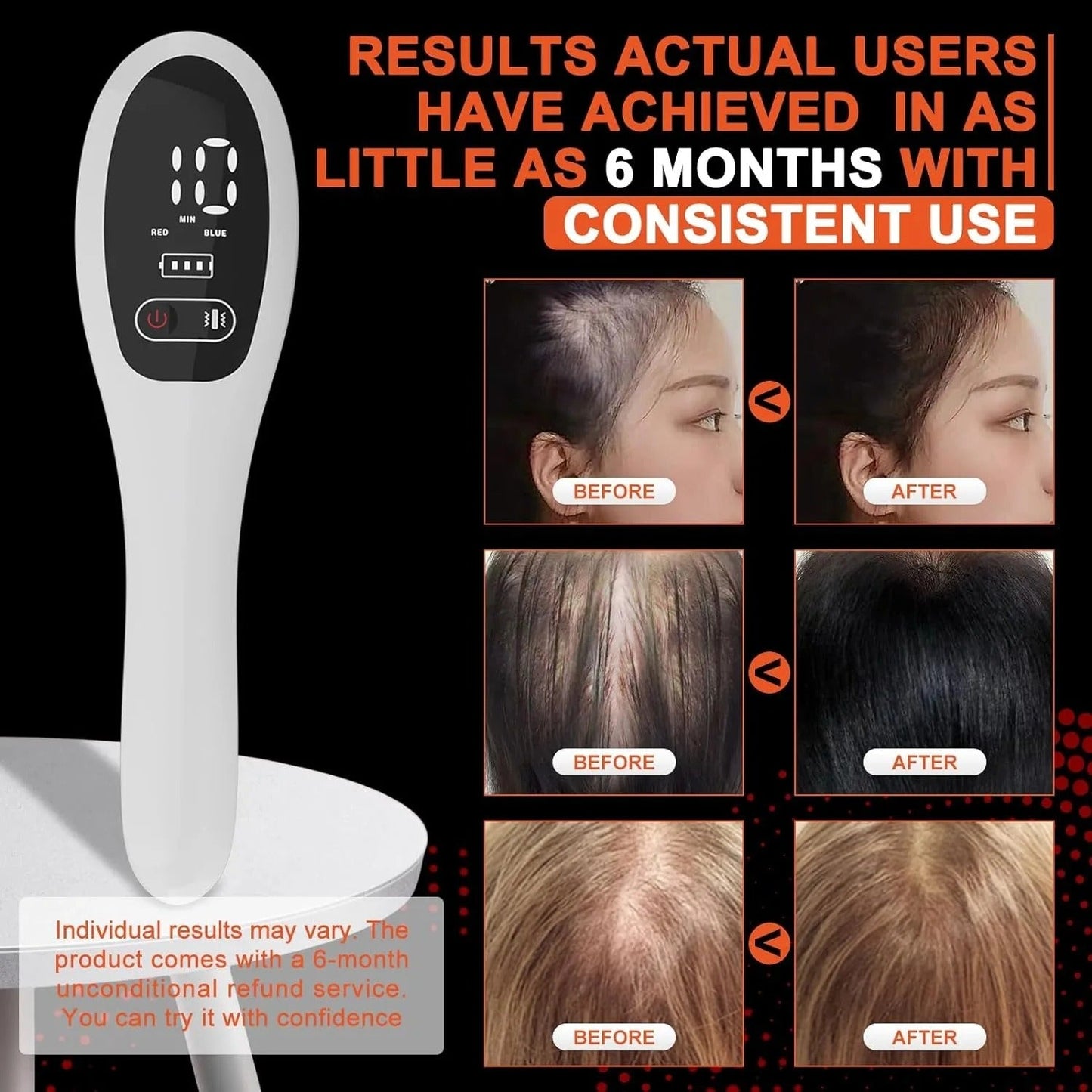 Electric Laser Hair Growth Comb Red Light Therapy Brush - RESTORALUX