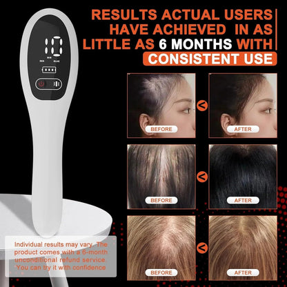Electric Laser Hair Growth Comb Red Light Therapy Brush - RESTORALUX
