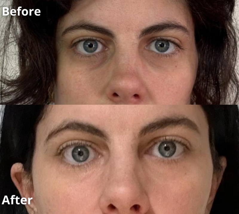 Anti Eye Bag Serum Roller