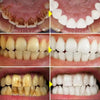Instant Teeth Whitening Powder - RESTORALUX