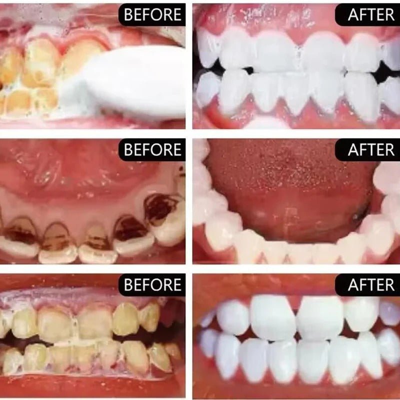 Instant Teeth Whitening Powder - RESTORALUX