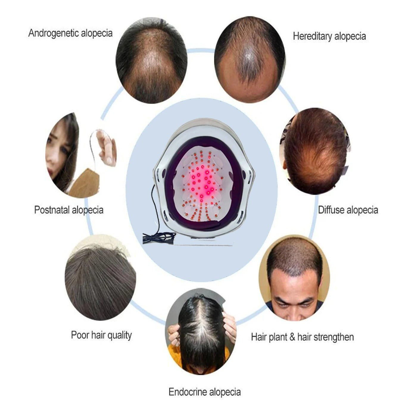Laser Hair Growth Cap Helmet for Hair Regrowth Therapy - RESTORALUX