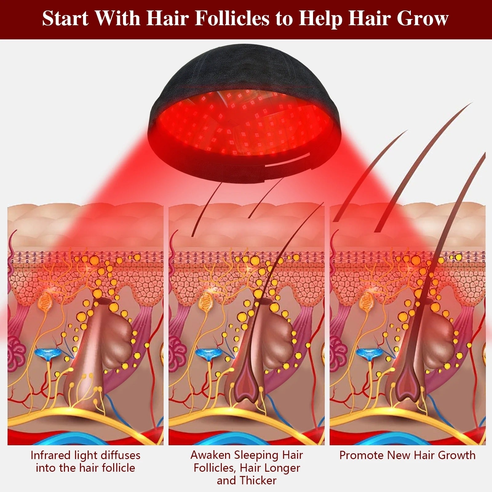 Laser Hair Growth Cap with 236 Diodes for Regrowth - RESTORALUX