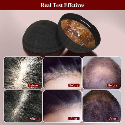 Laser Hair Growth Cap with 236 Diodes for Regrowth - RESTORALUX