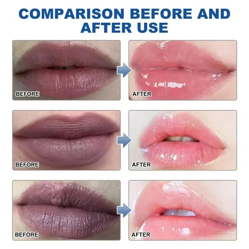 Lip Brightening Serum Balm - Fast Results - RESTORALUX