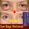 Restoralux Instant Dark Circles Removal Cream