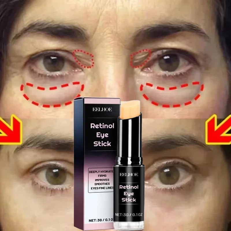 Instant Eye Bag Removal Stick – Collagen Anti-Wrinkle & Dark Circle Treatment for Puffy Eyes