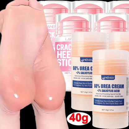 Urea Foot Cream – Dry & Cracked Heel Repair, Exfoliating & Ultra-Hydrating Care