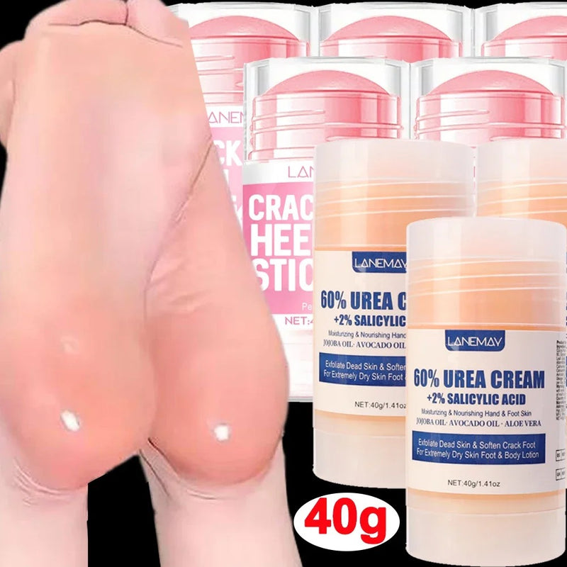 Urea Foot Cream – Dry & Cracked Heel Repair, Exfoliating & Ultra-Hydrating Care