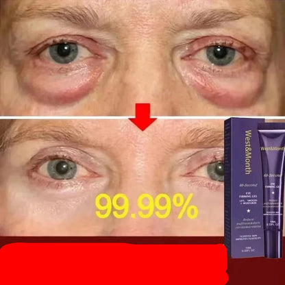 Restoralux Instant Dark Circles Removal Cream