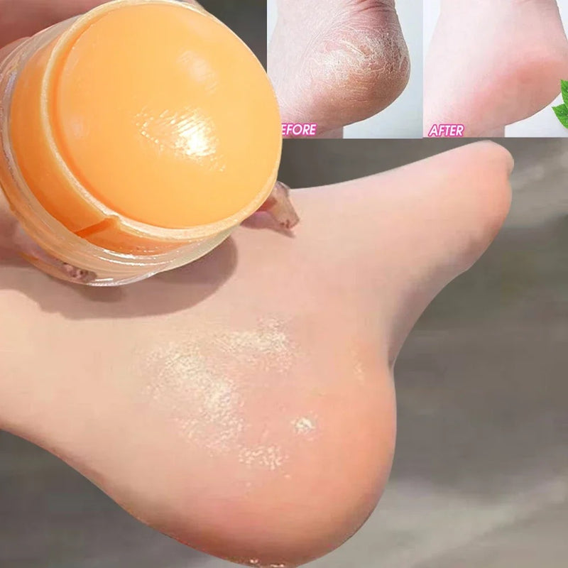 Urea Foot Cream – Dry & Cracked Heel Repair, Exfoliating & Ultra-Hydrating Care