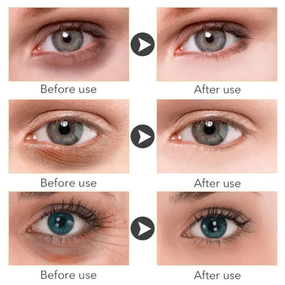 Retinol Eye Serum – Anti-Dark Circle, Anti-Wrinkle