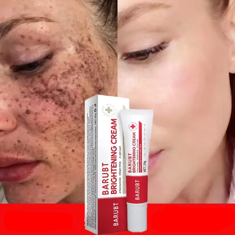 Whitening Freckles Face Cream