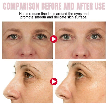 Instant Eye Bag Removal Stick – Collagen Anti-Wrinkle & Dark Circle Treatment for Puffy Eyes