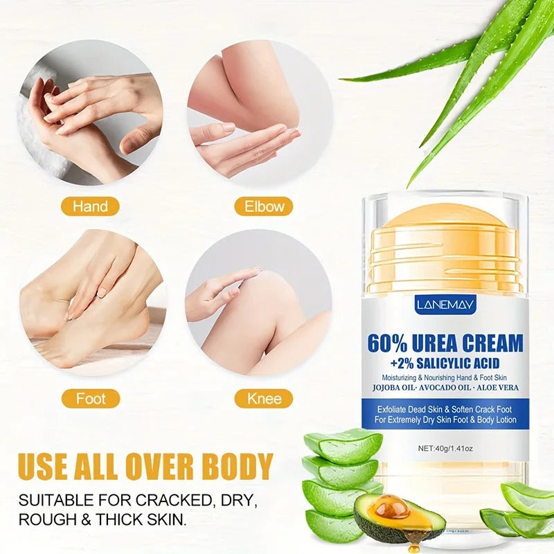 Urea Foot Cream – Dry & Cracked Heel Repair, Exfoliating & Ultra-Hydrating Care