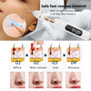 Laser Plasma Skin Tag Remover Pen Mole Freckle Eliminator