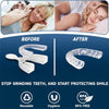 2-Pack Moldable Mouth Guard for Teeth Grinding, Sleeping & Whitening