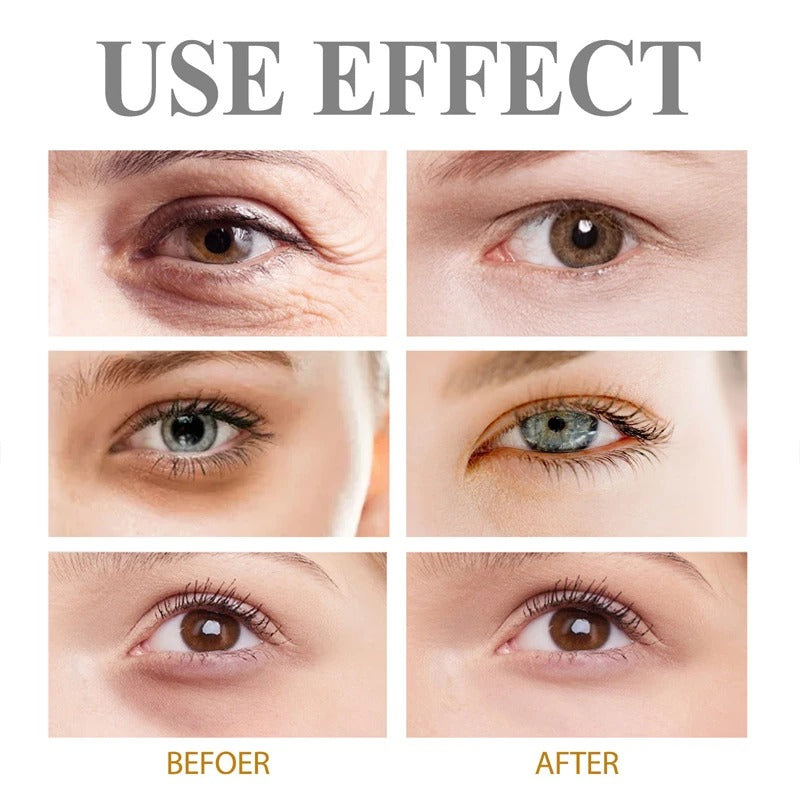 Restoralux Instant Dark Circles Removal Cream