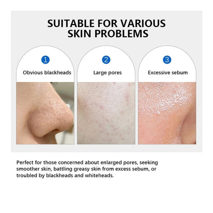 Zero Pore Pad 2.0 – Exfoliating & Pore-Smoothing Korean Facial Toner Pads (70pcs)