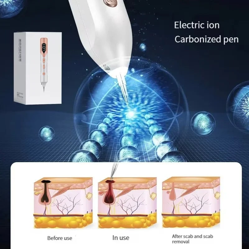 Laser Plasma Pen for Skin Rejuvenation