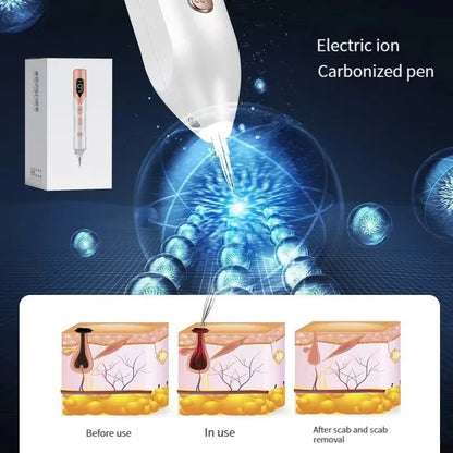 Laser Plasma Pen for Skin Rejuvenation