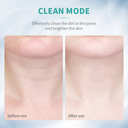 Neck & Face Lifting Device – LED Light Skin Tightening Tool