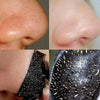 Bamboo Charcoal Blackhead Remover Mask – Pore Cleansing & Acne Care