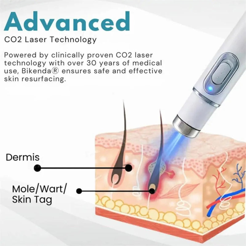 Laser Skin Spot Removal Pen with Blue Light Therapy